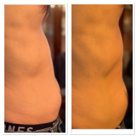 Nos prestations sur le secteur de près de Schiltigheim en Alsace