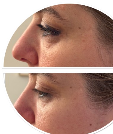 Nos prestations sur le secteur de à Strasbourg dans le Bas-Rhin